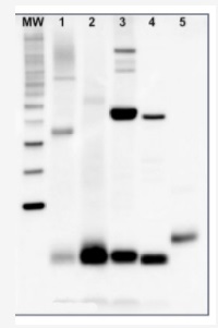 PsaC | PSI-C core subunit of photosystem I in the group Antibodies Plant/Algal / Global Antibodies at Agrisera AB (Antibodies for research) (AS10 939)